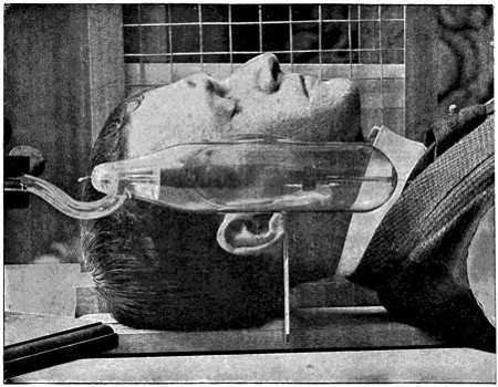 X-ray apparatus used to look inside skull